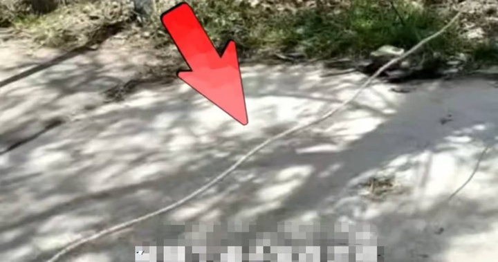 Một cậu bé 13 tuổi ở tỉnh Hà Nam, Trung Quốc đã bị siết cổ bằng dây thừng khi đang đạp xe, gây ra những tổn thương nghiêm trọng cho khí quản và thực quản. (Ảnh: Sohu)