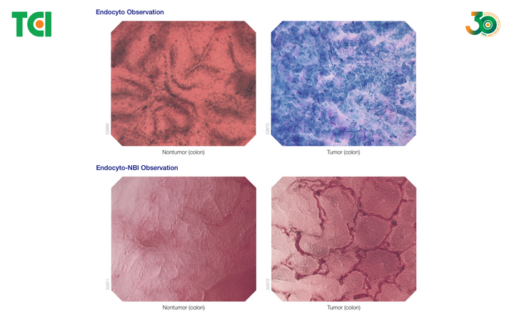 Tổn thương mô học tại đại tràng.