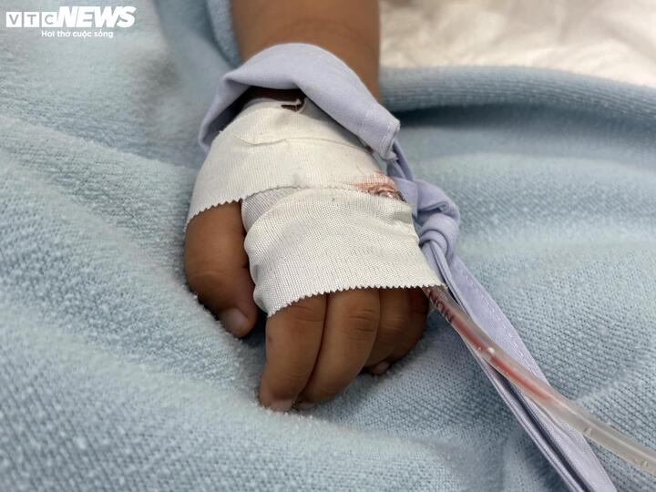 Bác sĩ cảnh báo, trẻ nhập viện trễ có thể dẫn đến các biến chứng nặng.