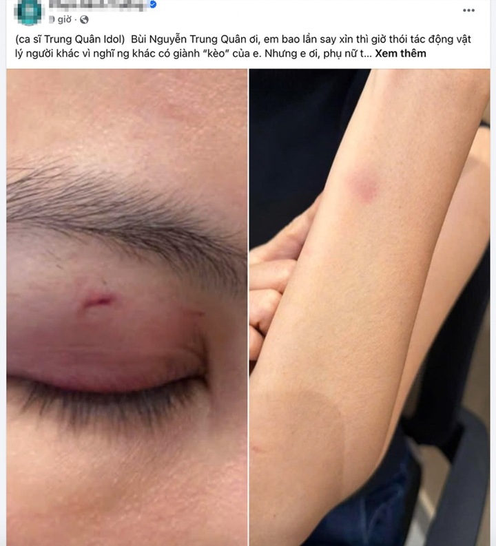 Bác sĩ P.M.T. chia sẻ thông tin về vụ việc vợ mình bị hành hung gây thương tích. Ảnh: Chụp màn hình