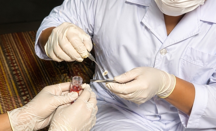 Nhân viên y tế lấy hai giác mạc theo đúng quy định chuyên môn. (Ảnh: BVCC)