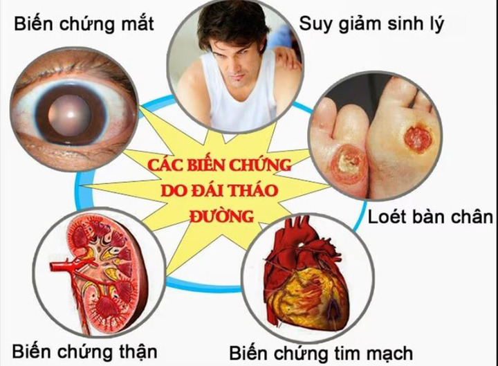 Biến chứng tiểu đường rất nghiêm trọng (Ảnh: BV Thu Cúc)