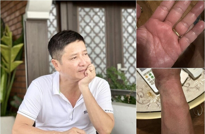 NSƯT Chí Trung mắc bệnh lạ, mất ngủ triền miên - 1
