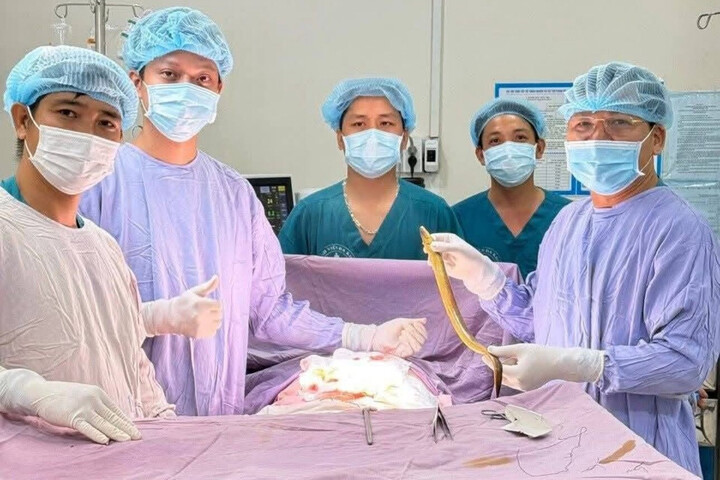 Các bác sĩ thực hiện ca phẫu thuật lấy con lươn trong ổ bụng ông L. (Ảnh: L.N)