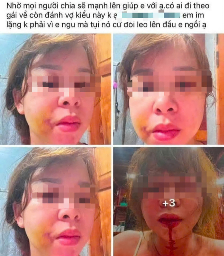 Chị D. đăng hình ảnh và clip lên mạng cầu cứu.