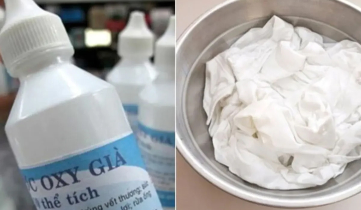 Đối với những vết ố vàng tồn tại lâu ngày, oxy già là lựa chọn đáng cân nhắc. (Ảnh minh họa)
