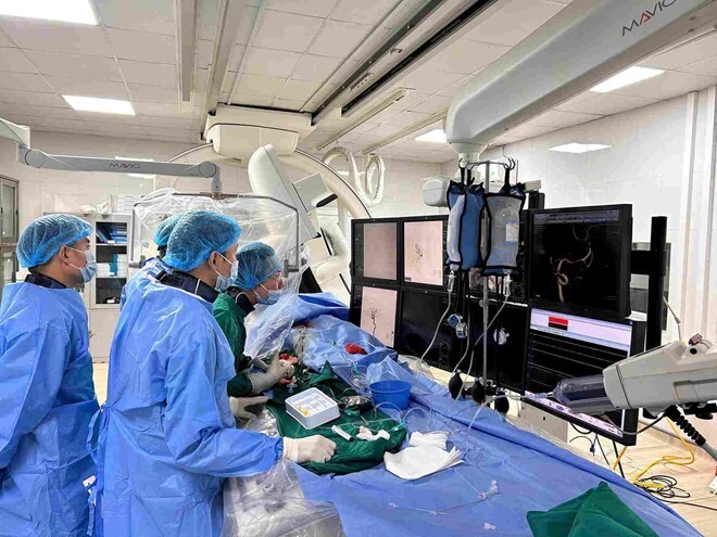 Đau đầu nhiều tháng, người phụ nữ phát hiện túi phình động mạch não kích thước hơn 5 mm. (Ảnh: BVCC)