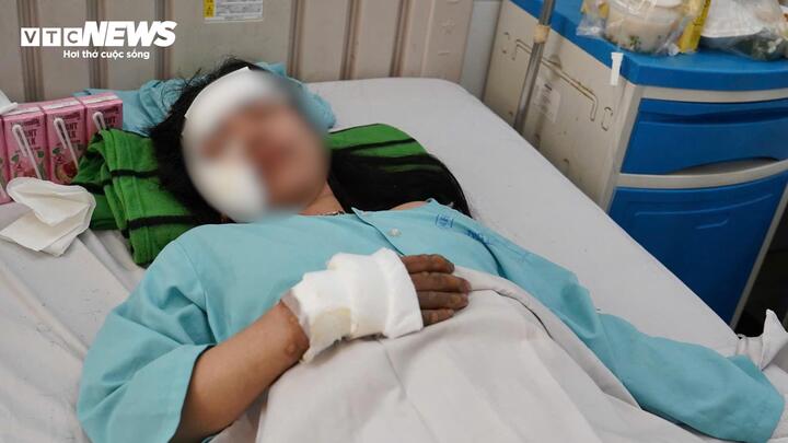 Nạn nhân sống sót kể giây phút ám ảnh khi xe khách bốc cháy làm 7 người tử vong nan nhan 4 14034113 - Nạn nhân sống sót kể giây phút ám ảnh khi xe khách bốc cháy làm 7 người tử vong