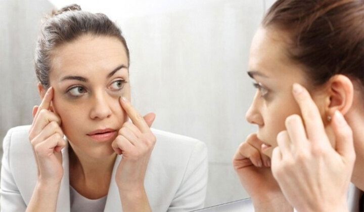 Quầng thâm, bọng mắt không chỉ do thiếu chăm sóc mà còn liên quan đến lão hóa, thiếu ngủ, căng thẳng và sức khỏe bên trong cơ thể.