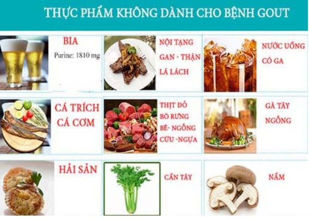 Người bị gút cần tránh những thực phẩm này nếu không bệnh sẽ tiến triển xấu - 1