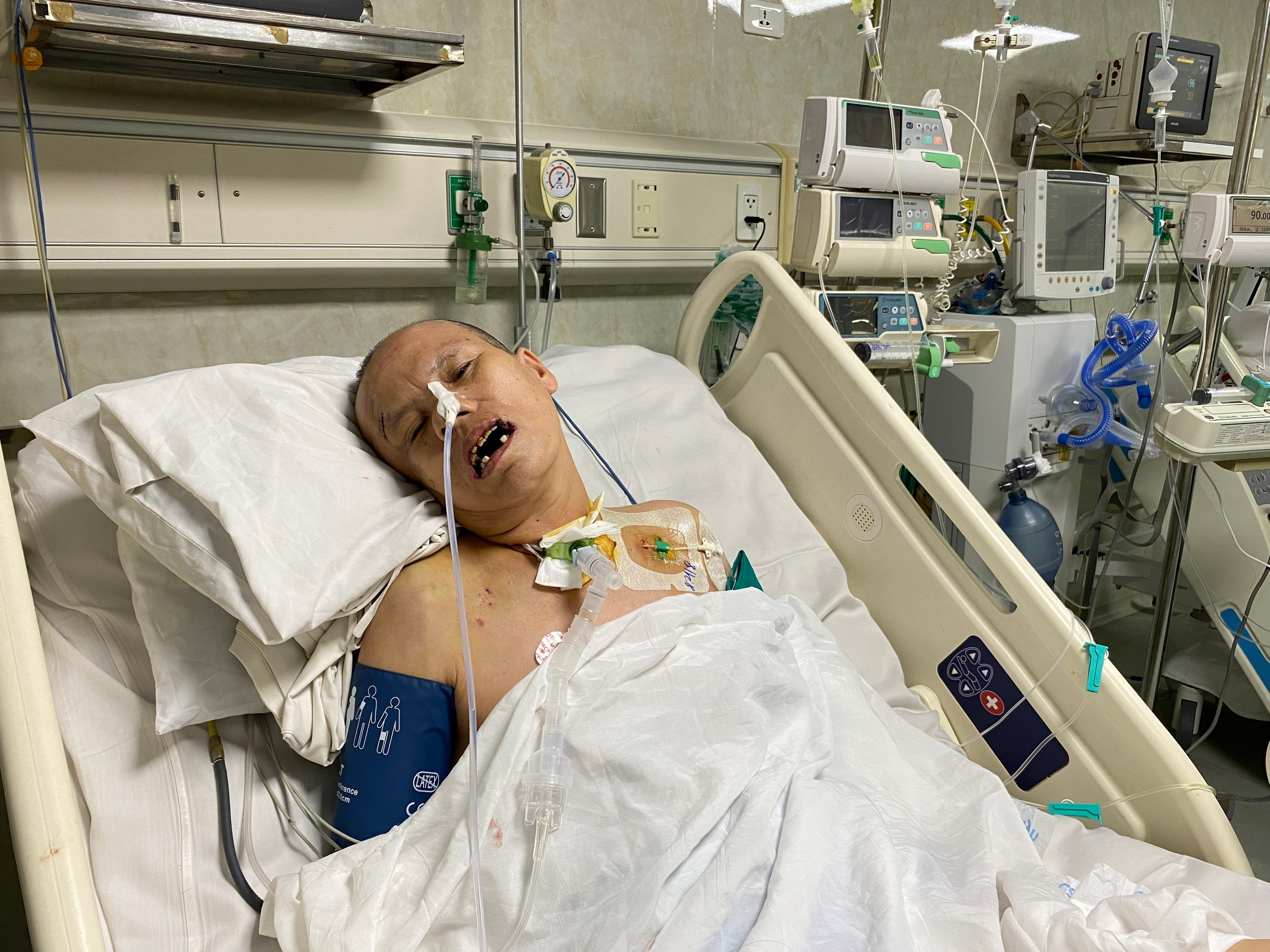 Bà Đức tỉnh xong sức khoẻ yếu, vẫn cần thở máy qua nội khí quản.