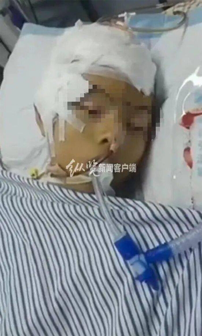 Liêu Mỗ Mỗ đang được cấp cứu trong tình trạng nguy kịch ở Bệnh viện Châu Giang, Quảng Châu.