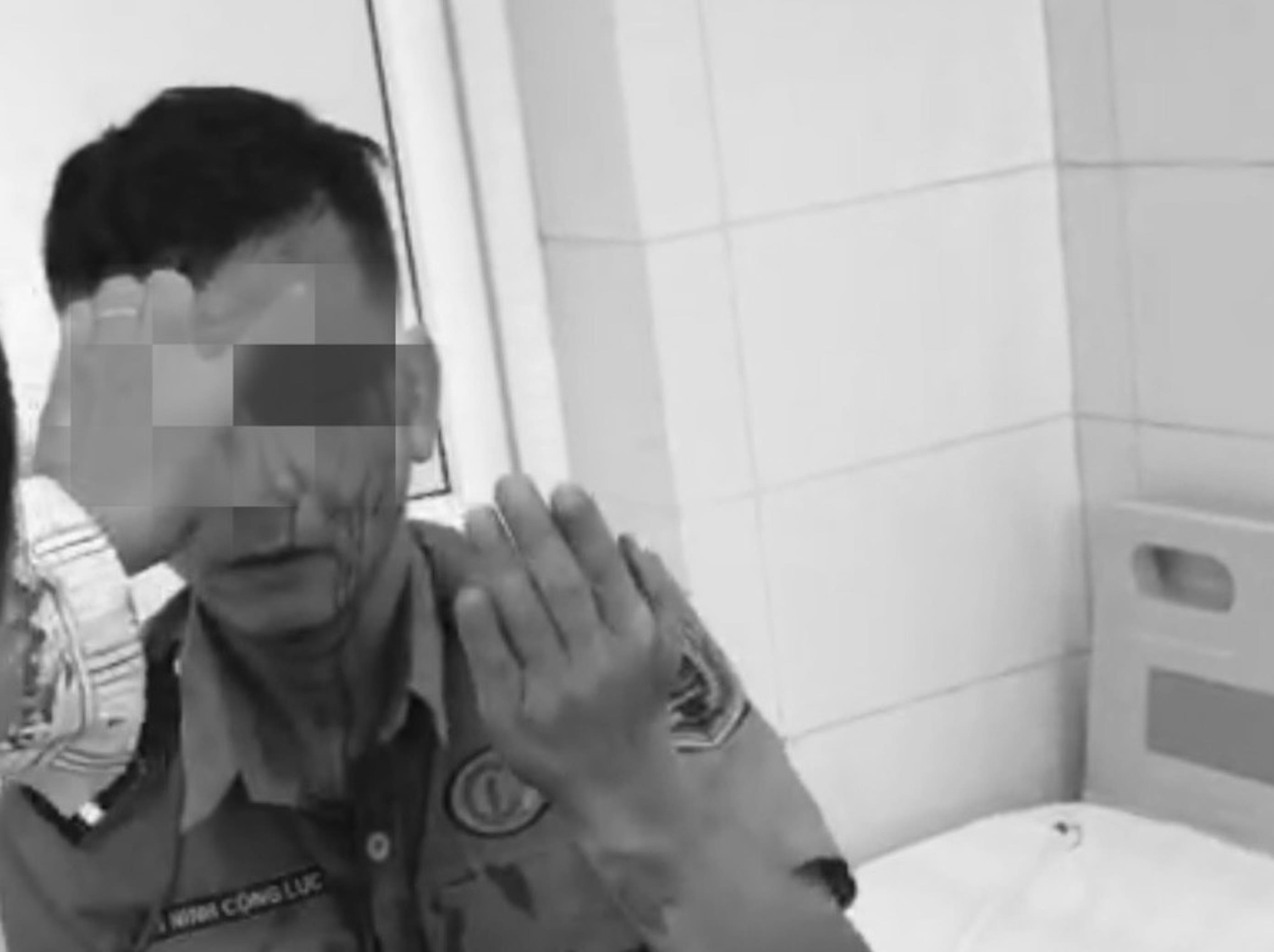 Bảo vệ bị hành hung gây thương tích nhiều vị trí trên cơ thể. (Ảnh: BVCC)