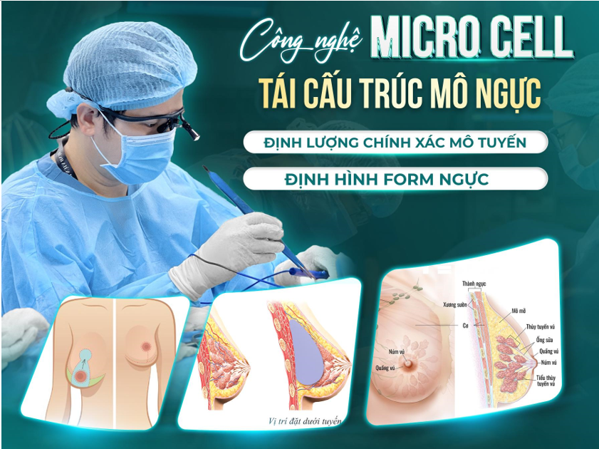 Độ bền của ngực sa trễ phụ thuộc rất nhiều vào kĩ thuật của bác sĩ.