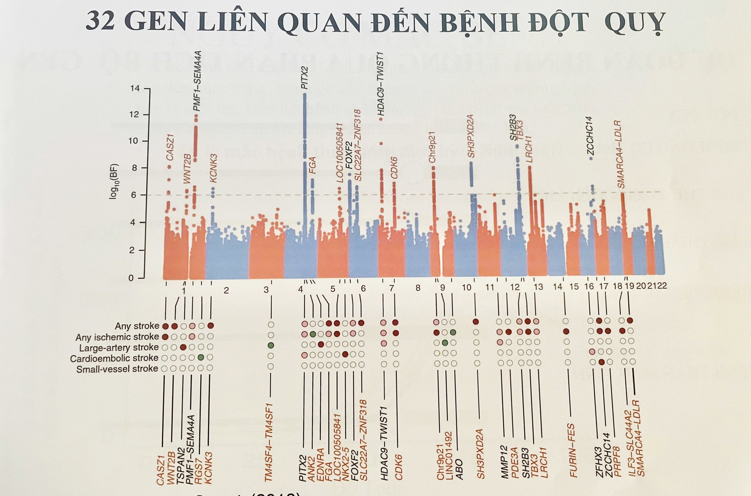 Bộ mã 32 gene liên quan đến bệnh đột quỵ. (Ảnh: BTC)