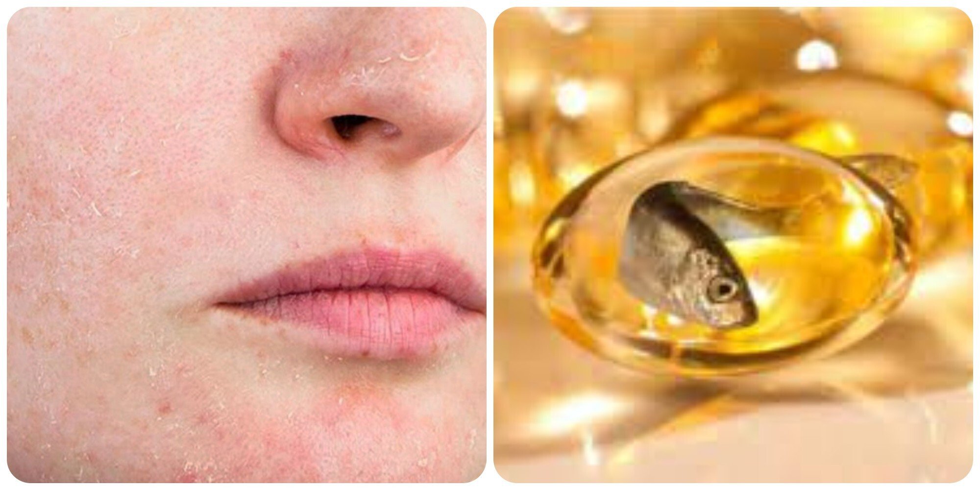 Omega-3 là dưỡng chất cần thiết cho cơ thể