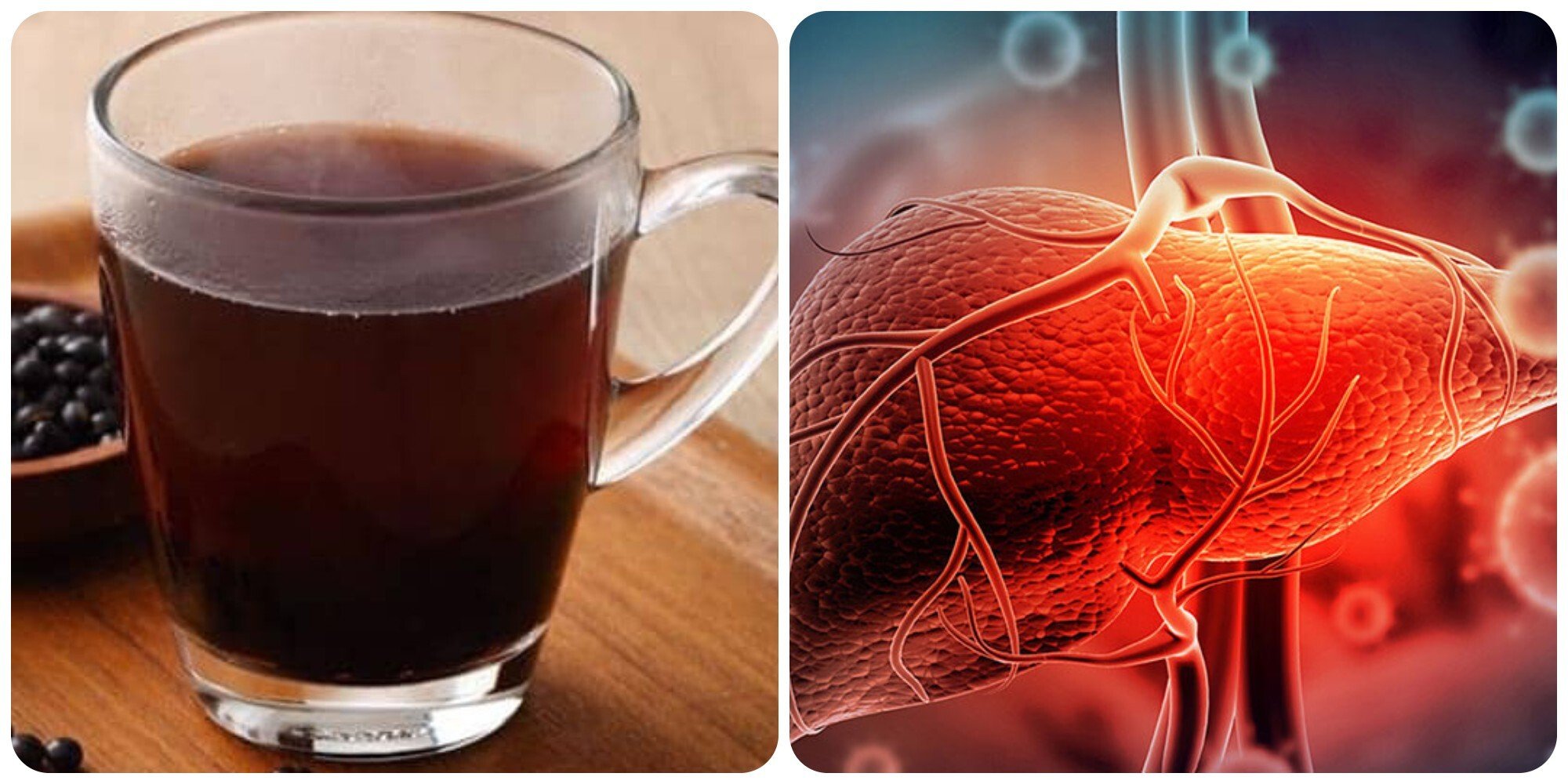 Uống nước đậu đen có tốt cho gan không là băn khoăn của nhiều người