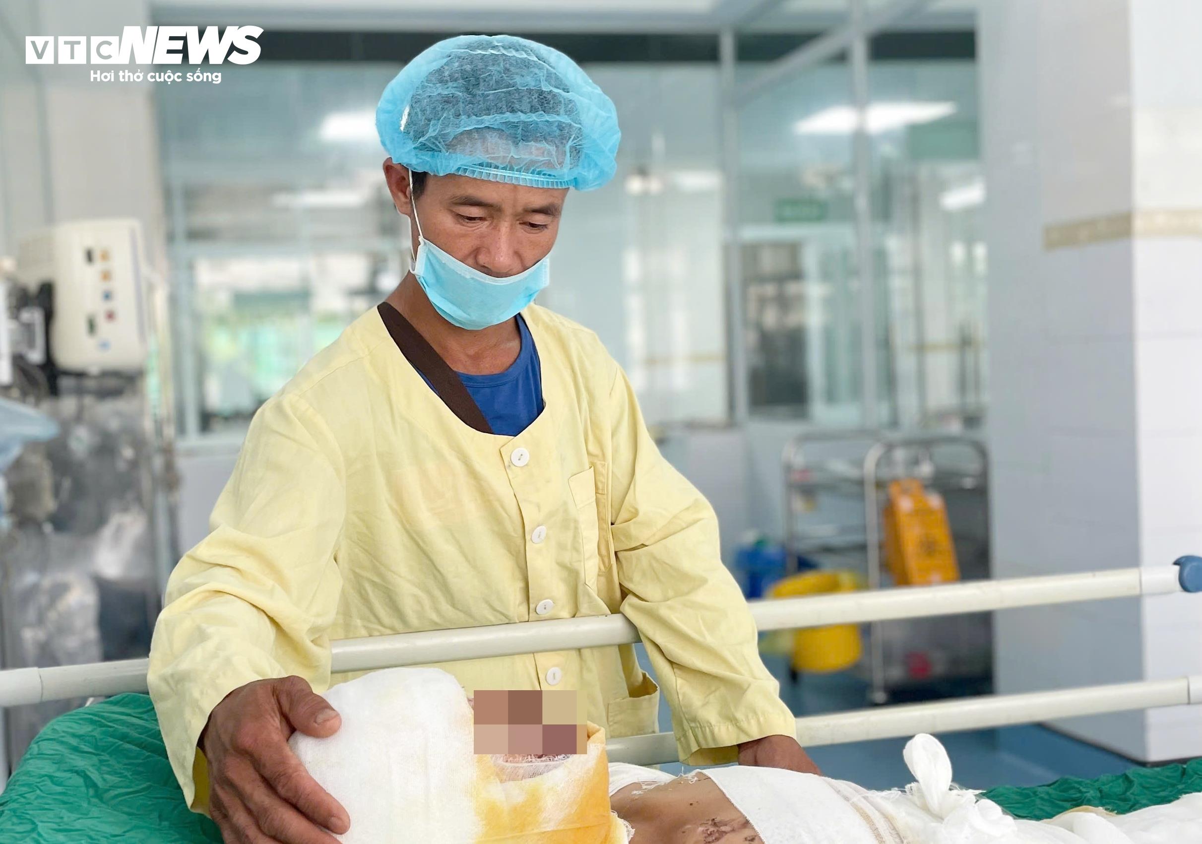 Thiện được chẩn đoán bỏng 45% cơ thể. (Ảnh: Như Loan)