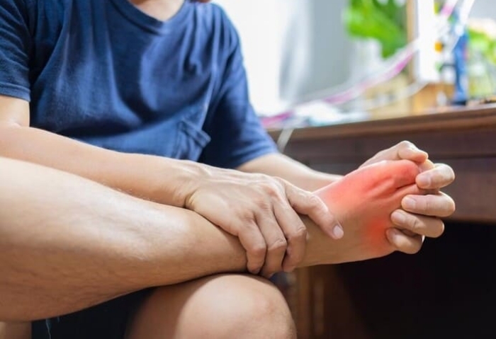 Bệnh Chikungunia đặc trưng bởi sốt cao, khởi phát đột ngột, thường kèm theo đau khớp dữ dội. (Ảnh minh hoạ)